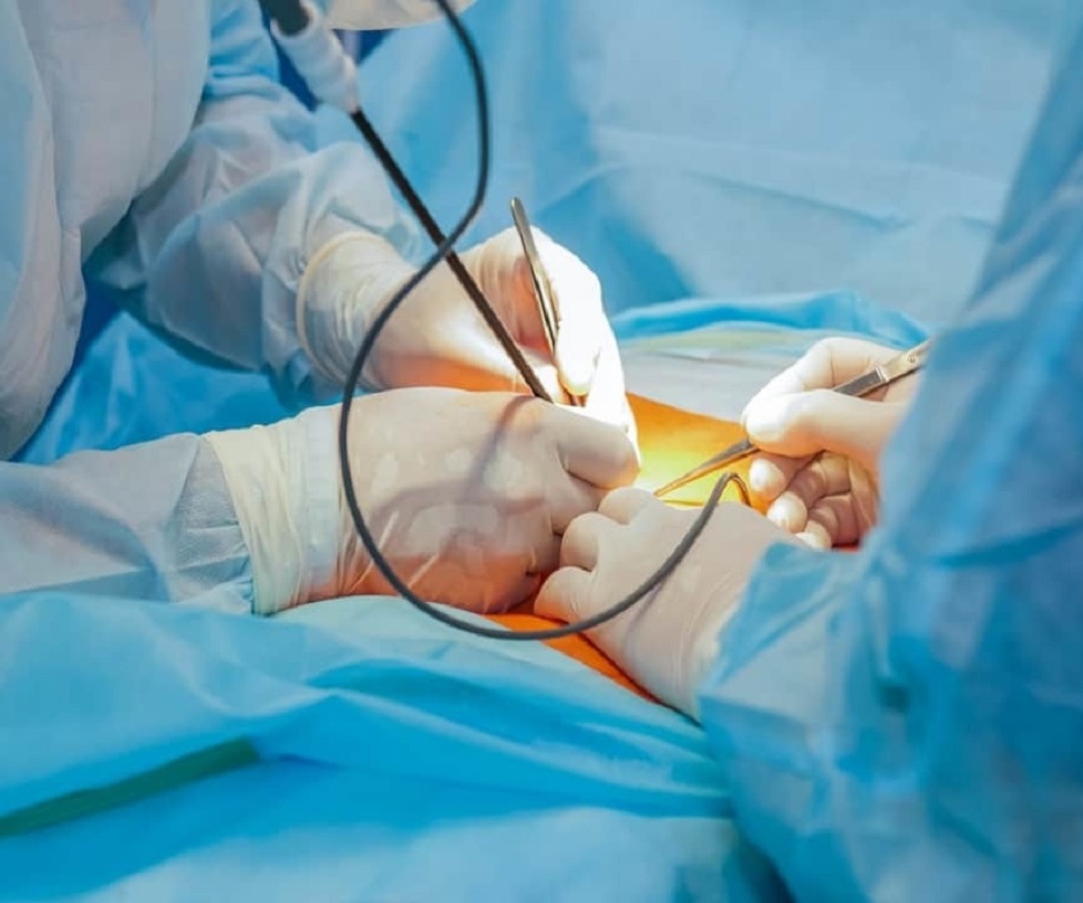 Fertility-Preserving Laparoscopy in Nashik