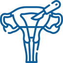 Total Laparoscopic Hysterectomy